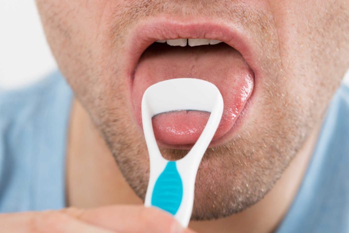 terapi amandel lidah bersih